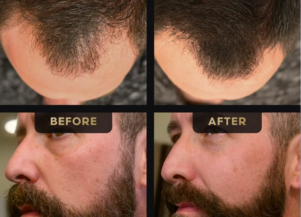 Beard Pen and Hair Concealer Bundle